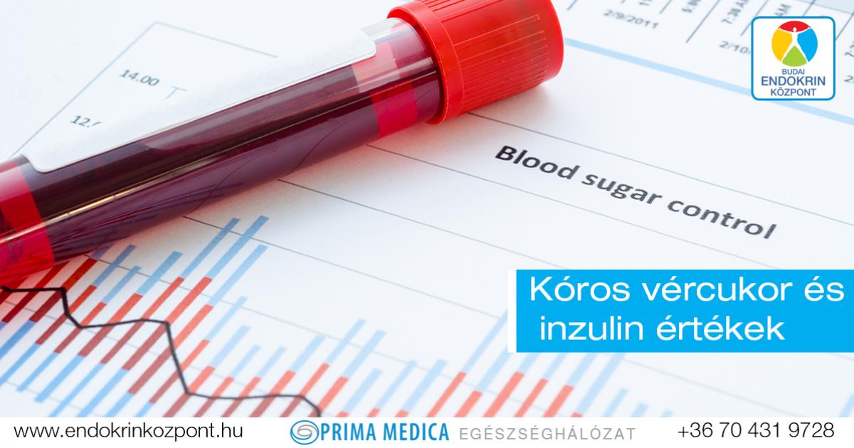 Mikortól kóros az inzulin és a vércukor szintje? - HáziPatika