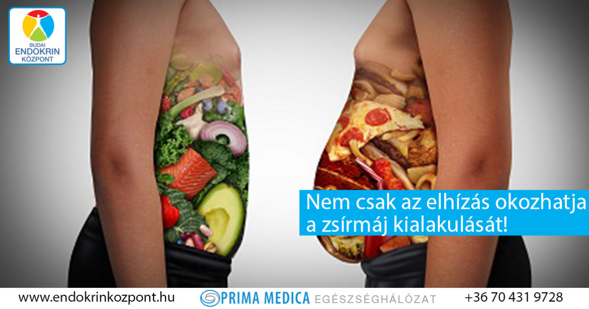 fejfájás cukorbetegség kezelésére