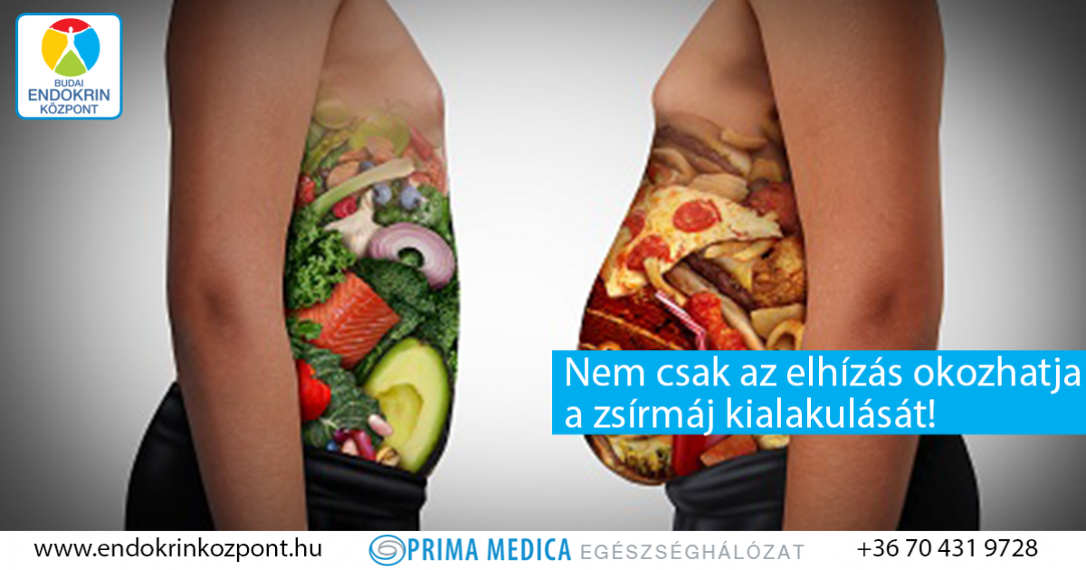 cukor diabetes kezelés táplálkozás.