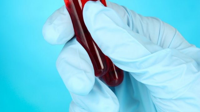 Ezek a hormonális eltérések fordulnak elő gyakran az IR mellett