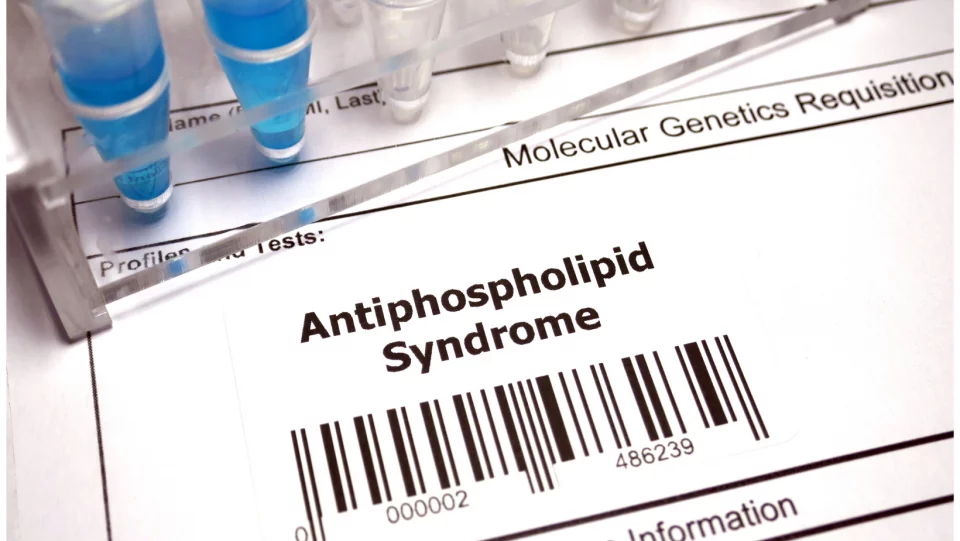 Antifoszfolipid szindróma